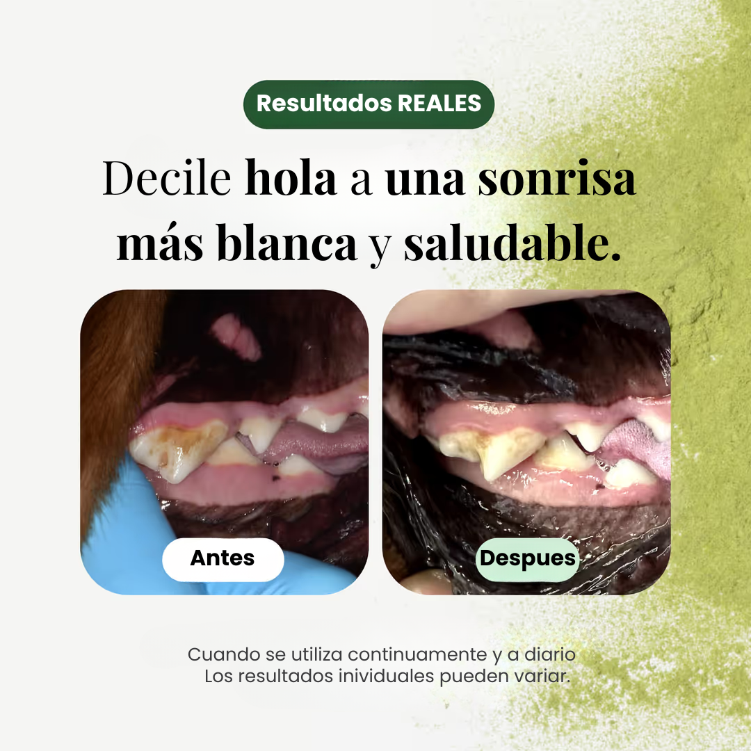 ProBright® - Reducción de sarro y encías saludables sin cepillado